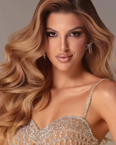 Miss Universe Paraná 2026 fica ferida em colisão com carreta